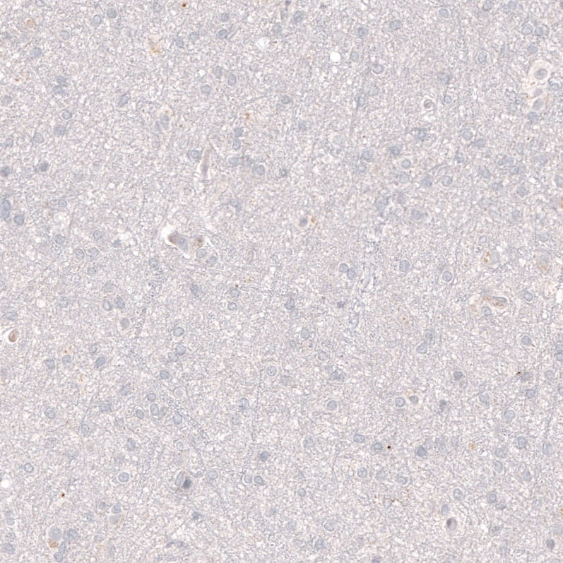 VMAT2 Antibody (CL12531) - BSA Free Immunohistochemistry: VMAT2 Antibody (CL12531) - BSA Free [NBP3-18570]
