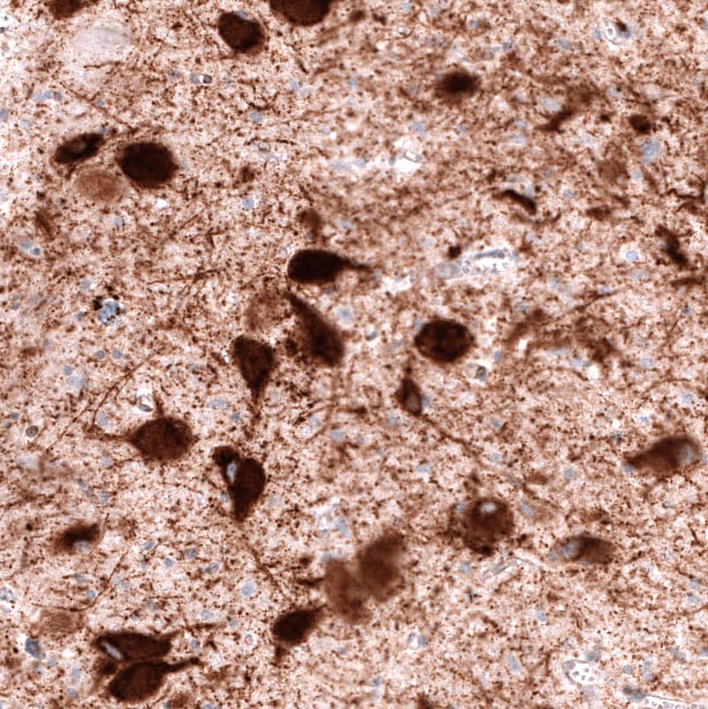 VMAT2 Antibody (CL12531) - BSA Free Immunohistochemistry: VMAT2 Antibody (CL12531) - BSA Free [NBP3-18570]