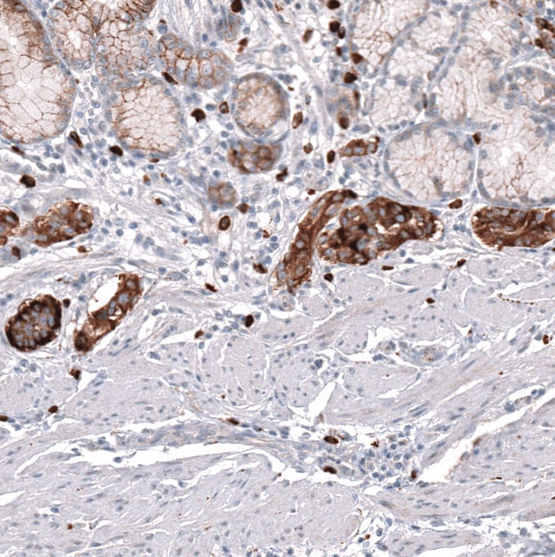 VMAT2 Antibody (CL12531) - BSA Free Immunohistochemistry: VMAT2 Antibody (CL12531) - BSA Free [NBP3-18570]