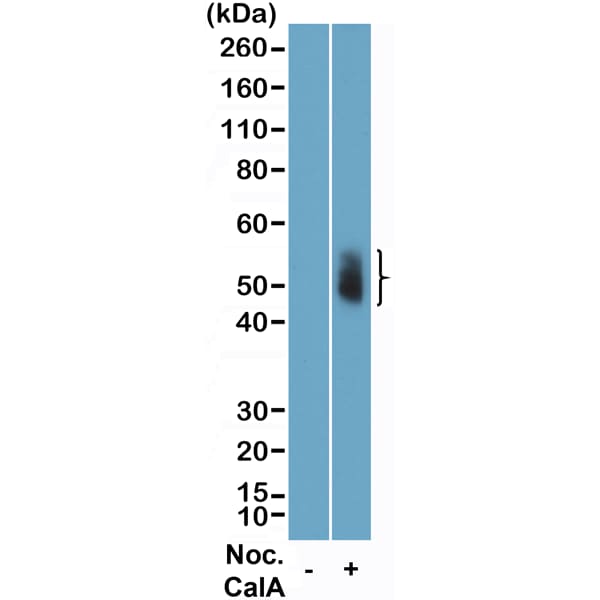 Aurora A/B/C Antibody (RM454)