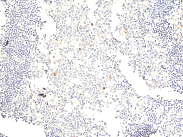 Aurora A/B/C Antibody (RM454)