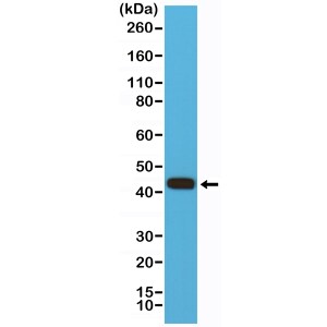 MMP-12 Antibody (RM381)