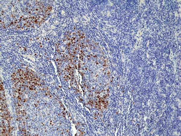 TOP2A Antibody (RM394)