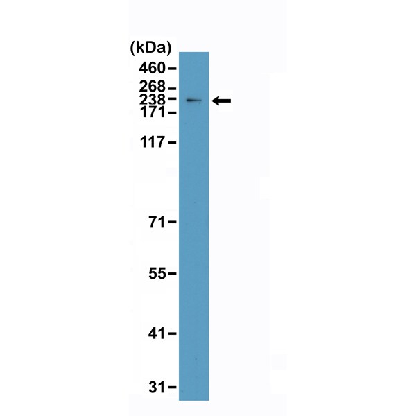 TOP2A Antibody (RM394)
