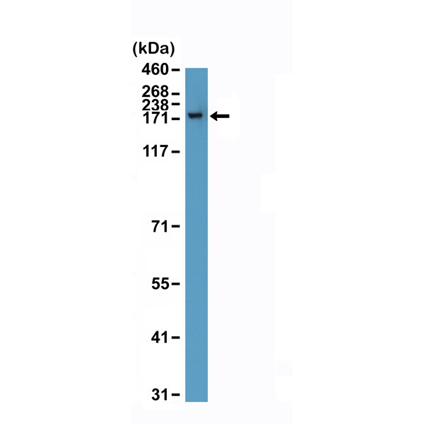 CPS1 Antibody (RM395)