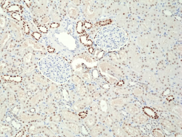 PAX8 Antibody (RM436)