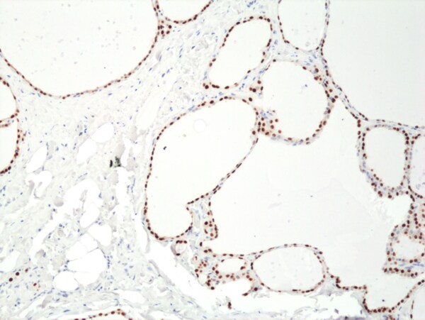 PAX8 Antibody (RM436)