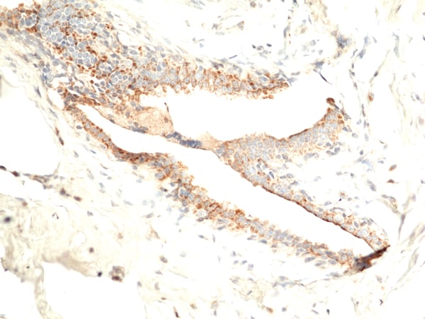 Fibrillin 1 Antibody (RM463)