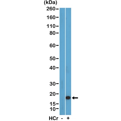 Histone H3 [Crotonyl Lys27] Antibody (RM401)