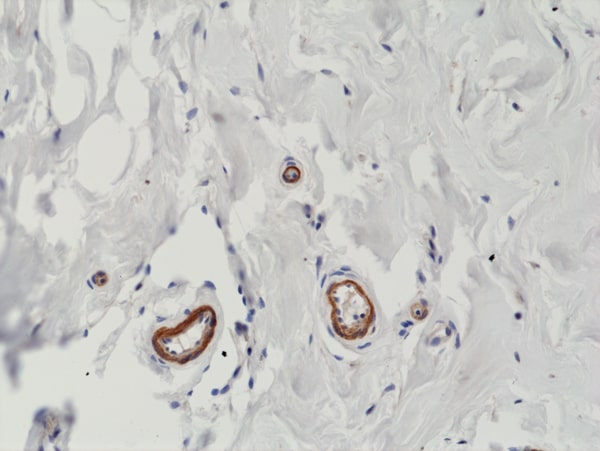 VEGF 165 Antibody (RM391)