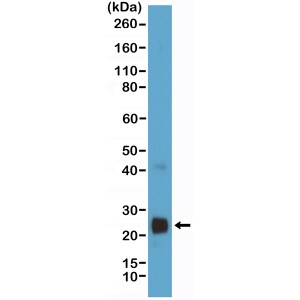 VEGF 165 Antibody (RM391)