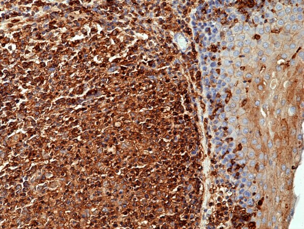 beta-Actin Antibody (RM112)