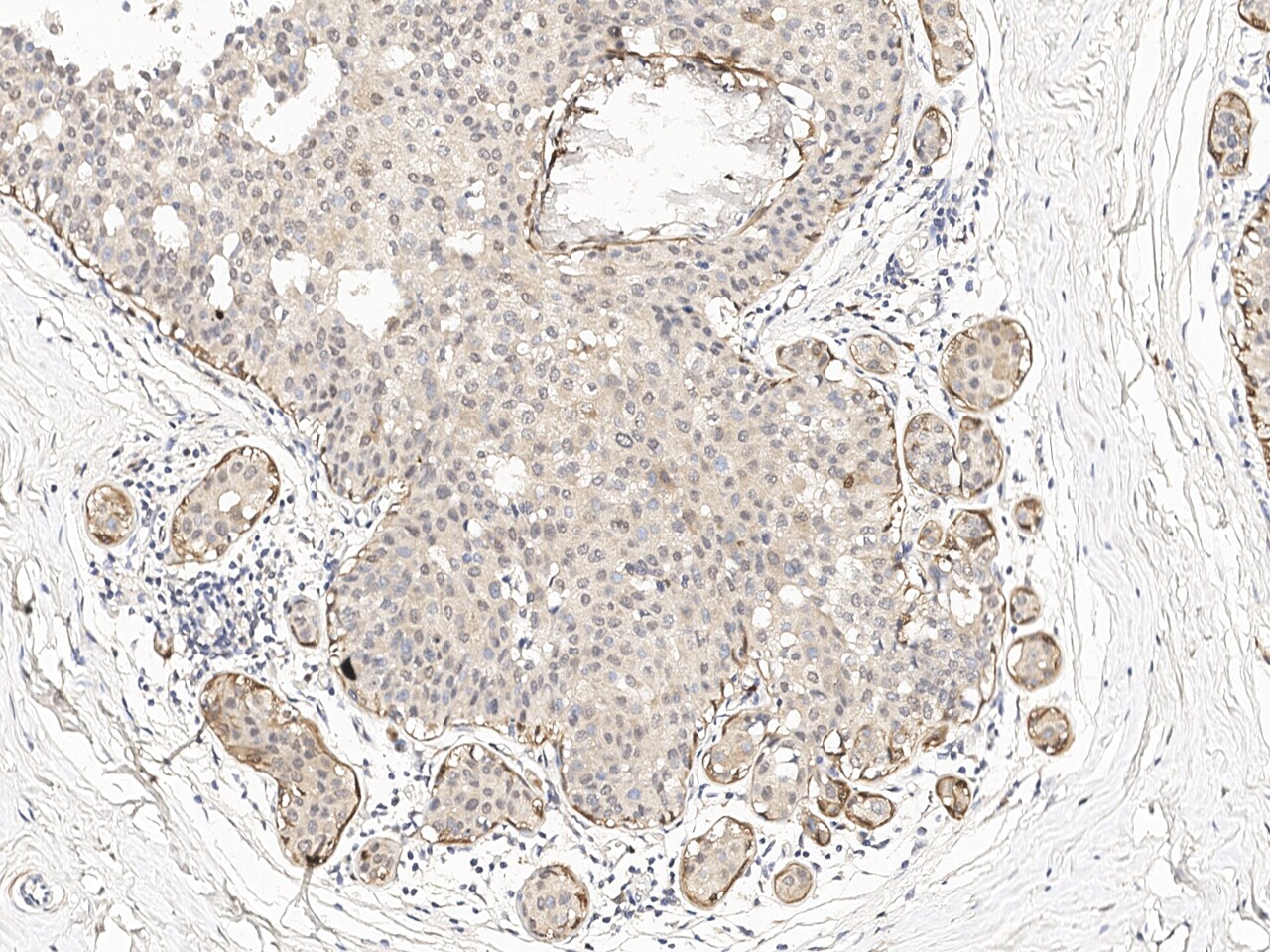 PHGDH Antibody