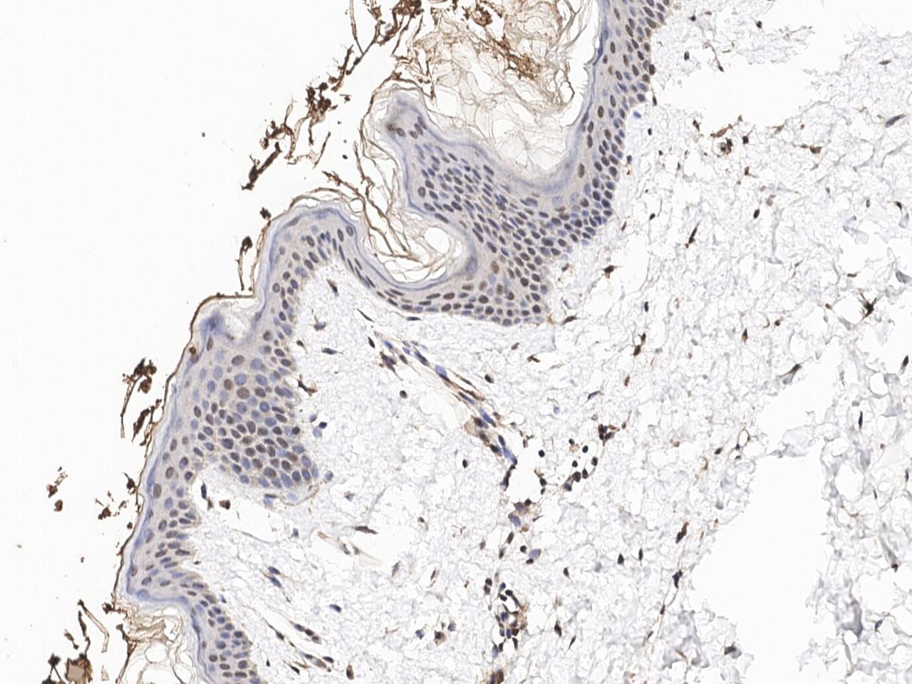 Nucleoporin 107 Antibody
