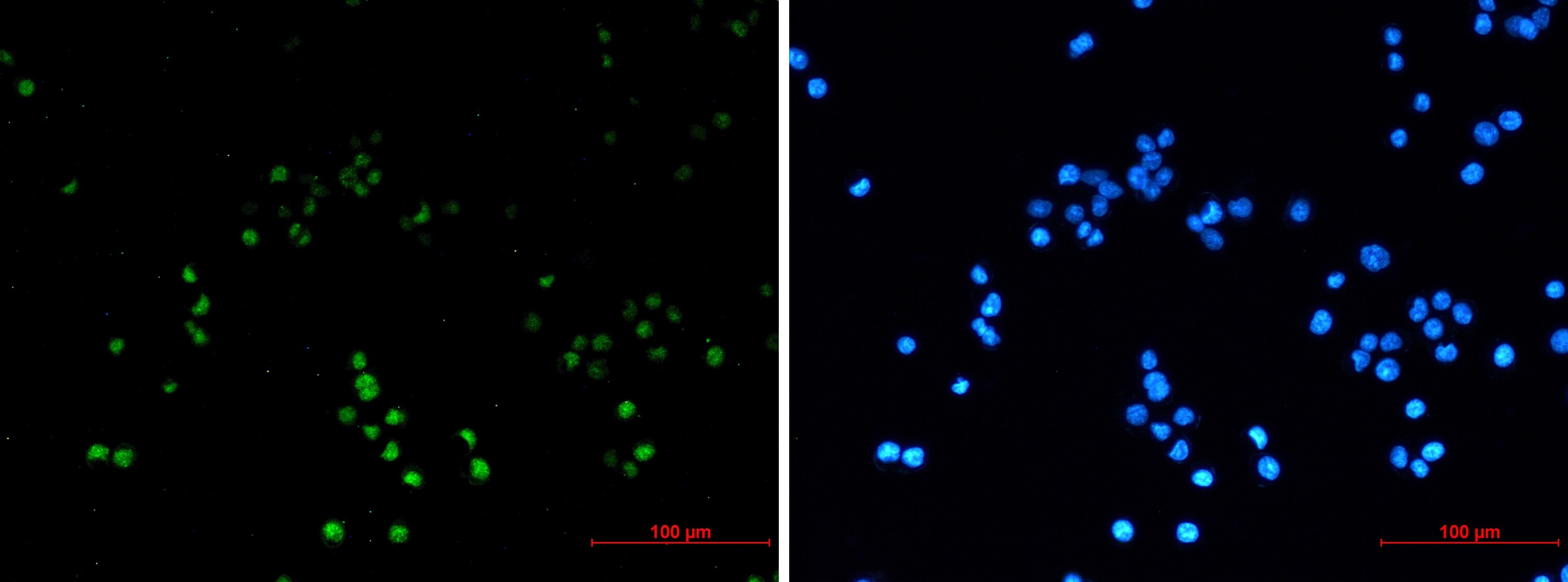 ZHX2 Antibody (S01-9B5)