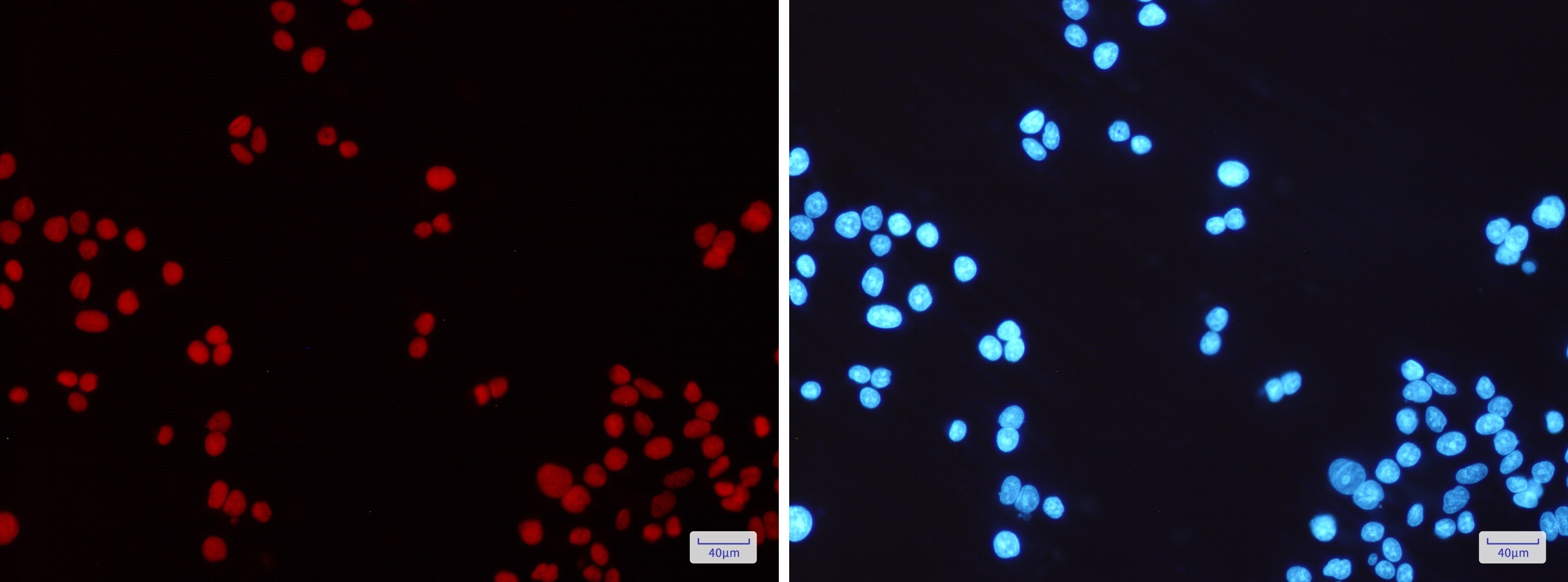 MSH6 Antibody (S05-2B5)