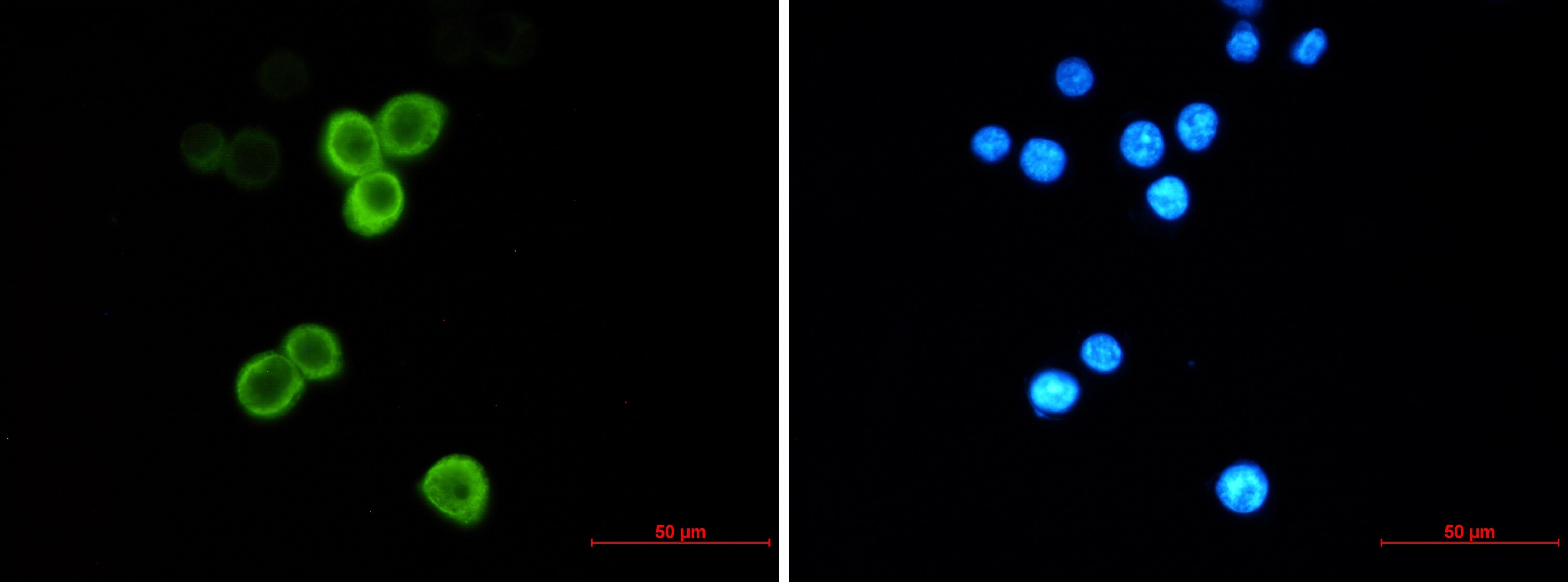AG-2/AGR2 Antibody (S04-1H6)