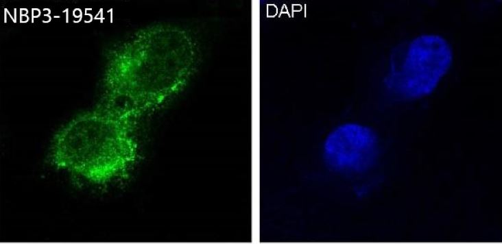 MCAM/CD146 Antibody (S05-5A2)