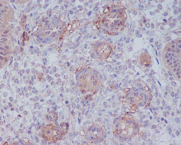 MCAM/CD146 Antibody (S05-5A2)