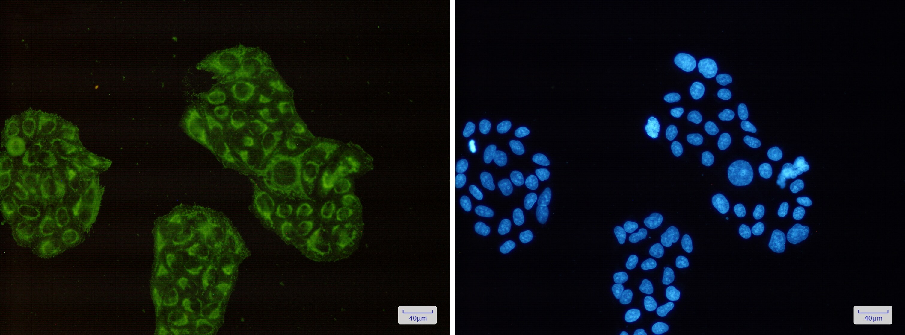 ACADM Antibody (S06-8F7)