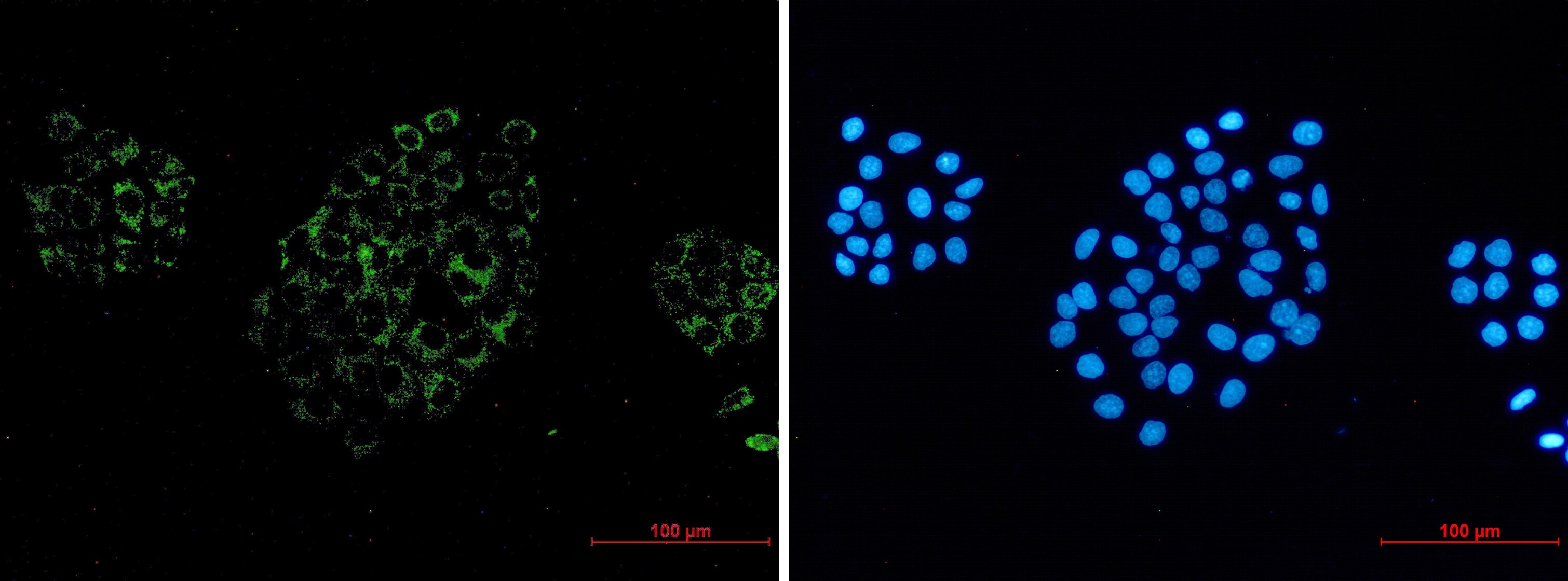 ACOX1 Antibody (S08-2E5)