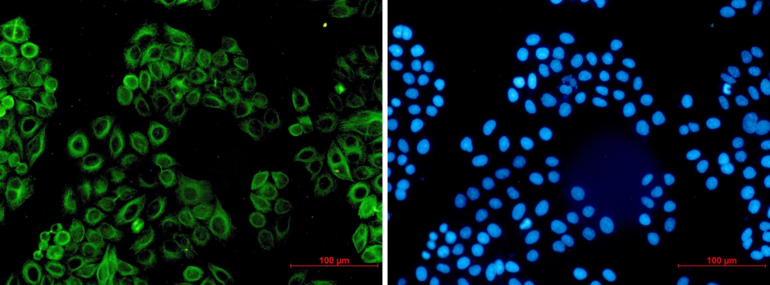 Activin RIB/ALK-4 Antibody (S08-8D6)