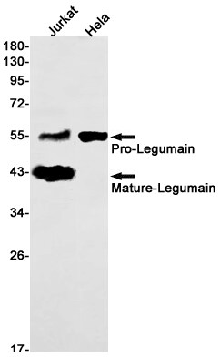 Legumain/Asparaginyl Endopeptidase Antibody (S06-7G1)