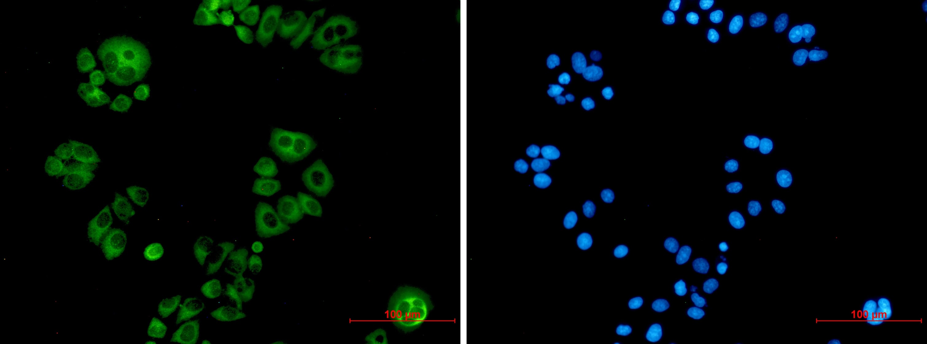 Alkaline Phosphatase, Tissue Non-Specific Antibody (S08-6H0)