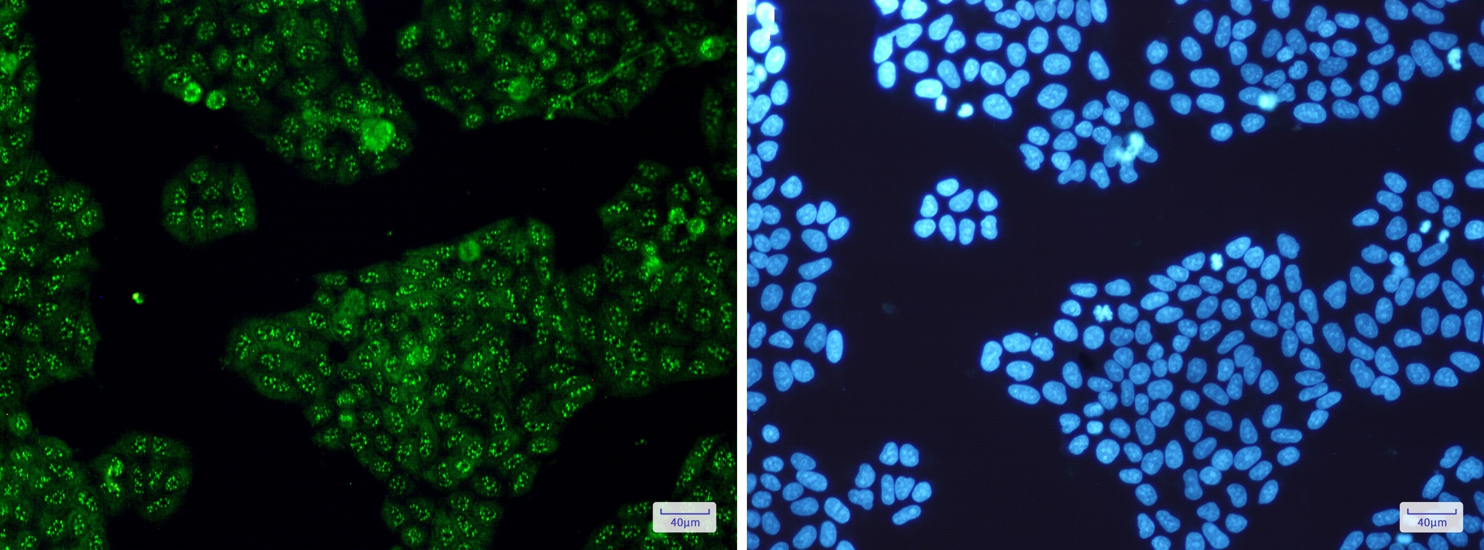 Calretinin Antibody (S01-2G7)