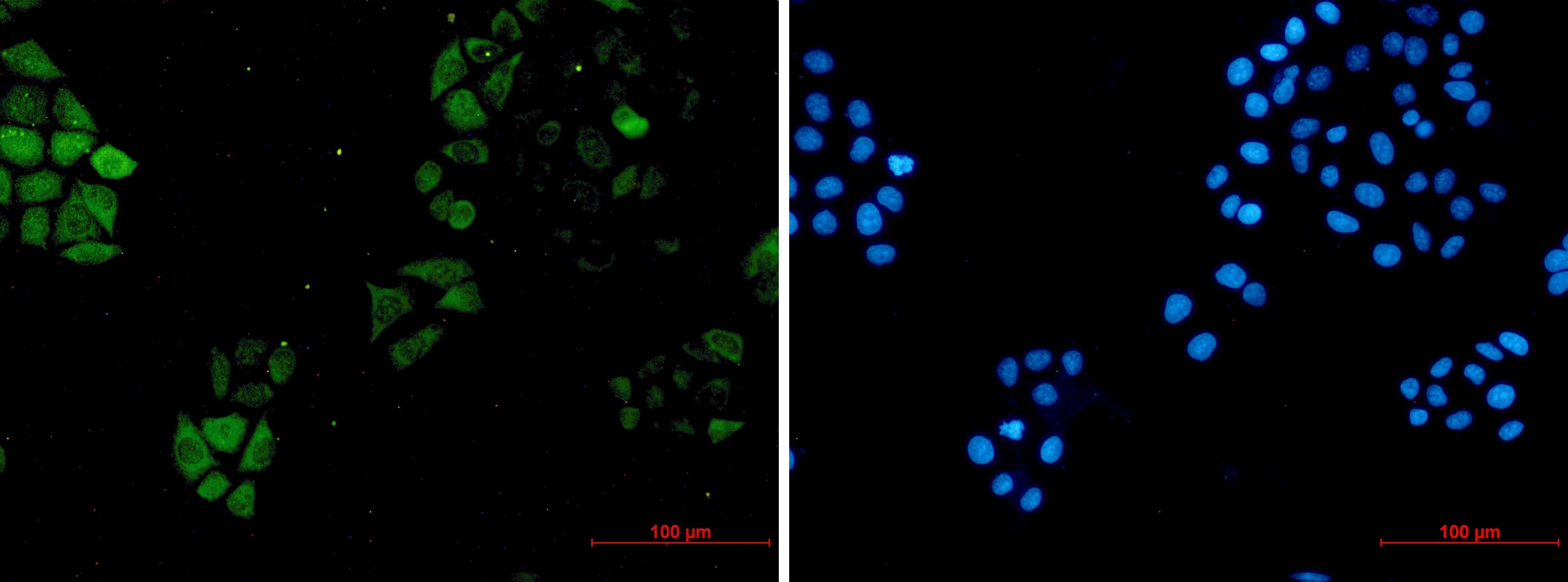 S100A4 Antibody (S01-7H1)