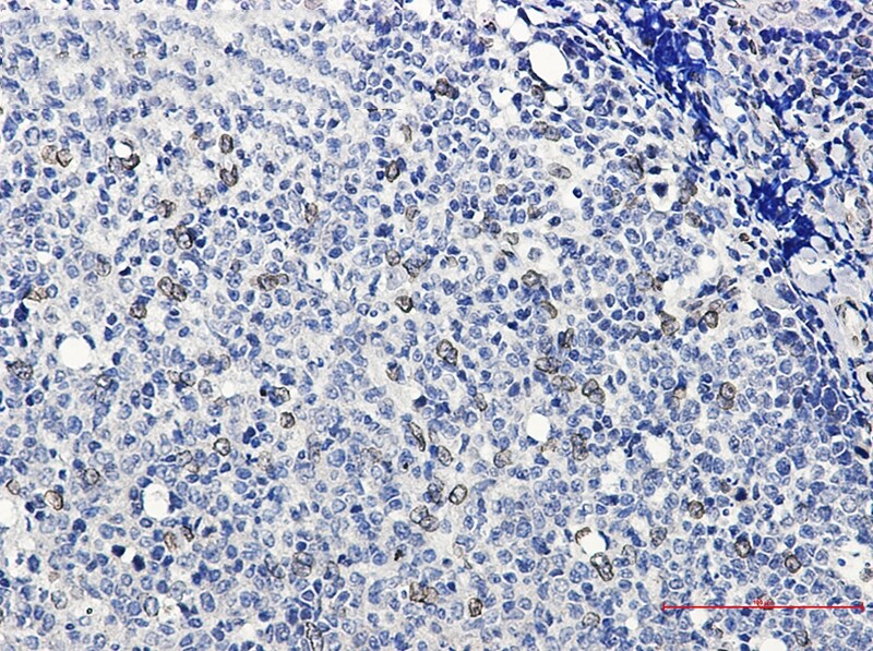 E2F-1 Antibody (S03-5G3)