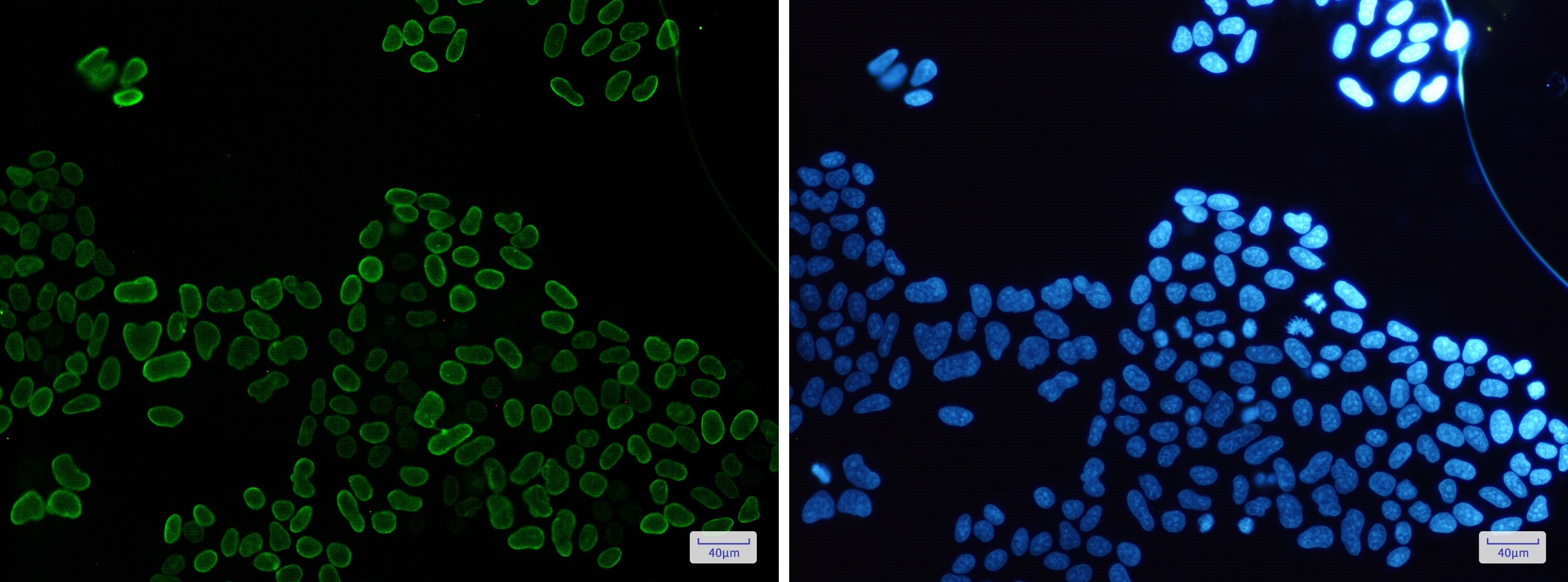 E2F-1 Antibody (S03-5G3)