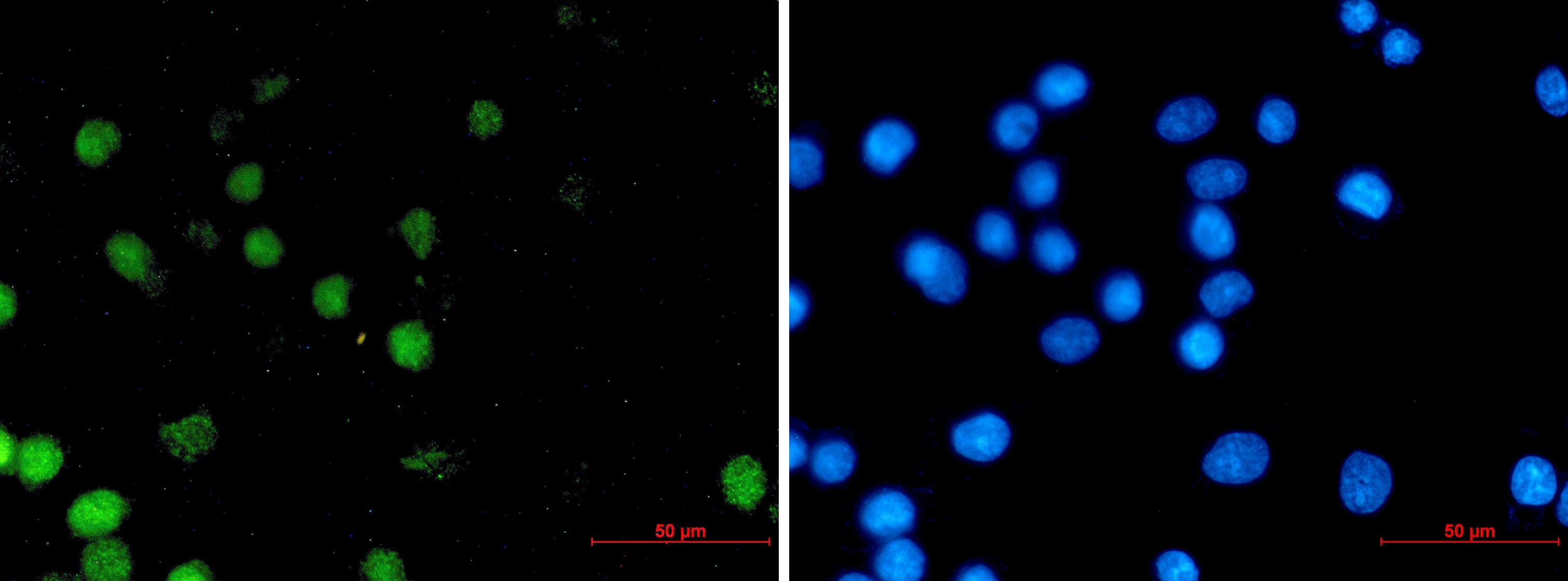 HNF-3 alpha/FoxA1 Antibody (S04-5A7)