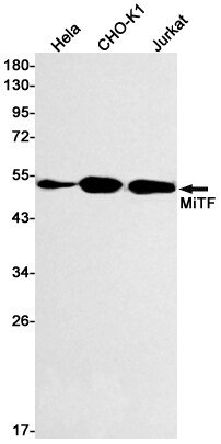 MITF Antibody (S06-4B5)