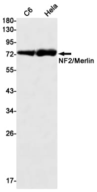 NF2/Merlin Antibody (S07-1A6)