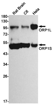 ORP1 Antibody (S02-2E2)
