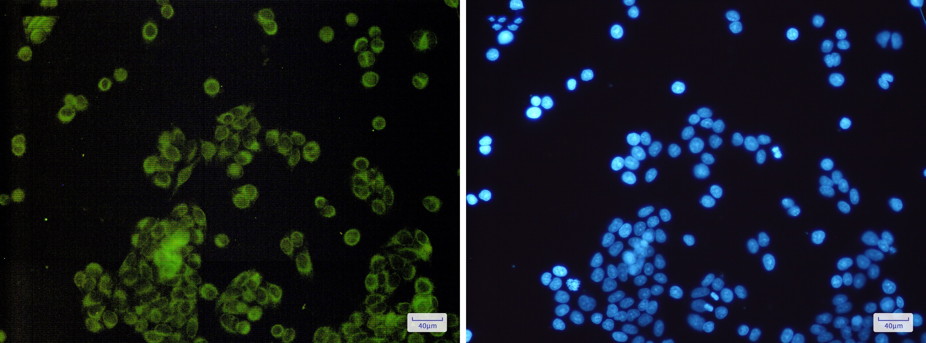 FATP4/SLC27A4 Antibody (S01-3C7)