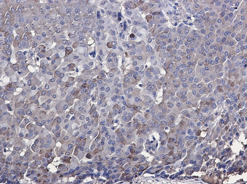 IRF7 Antibody (S04-1E1)