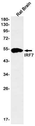 IRF7 Antibody (S04-1E1)