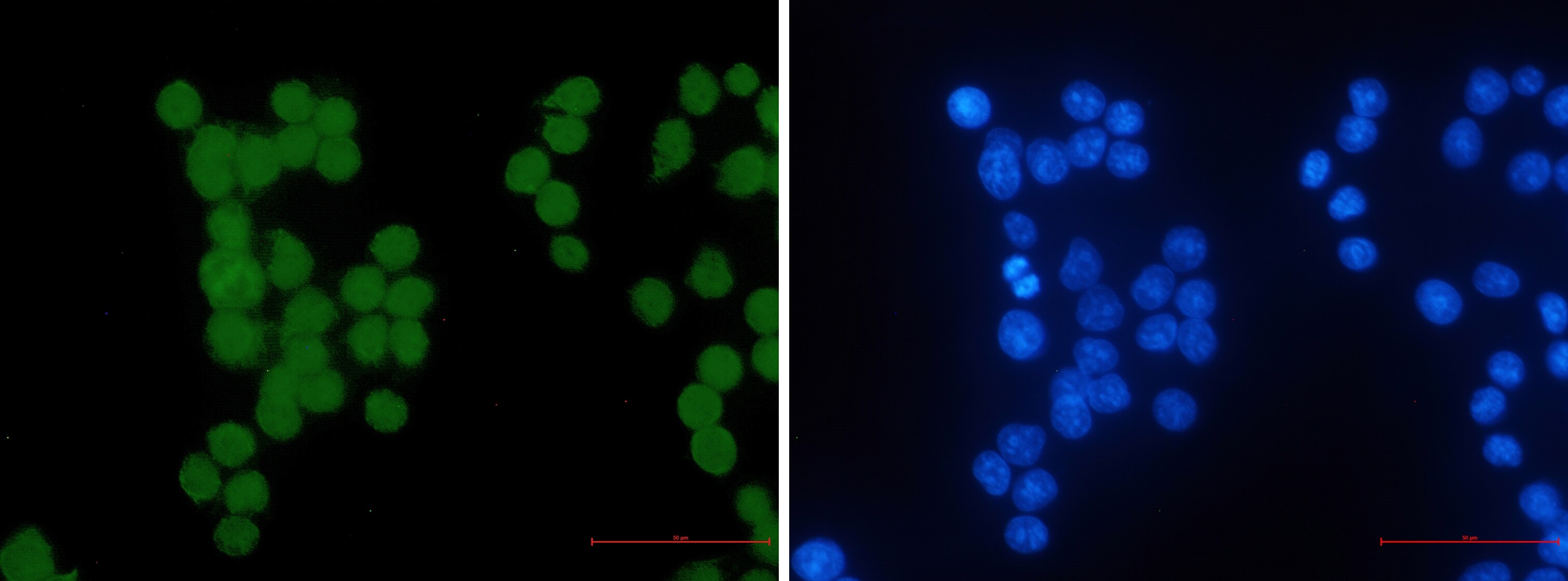 HIPK2 Antibody (S06-5G2)