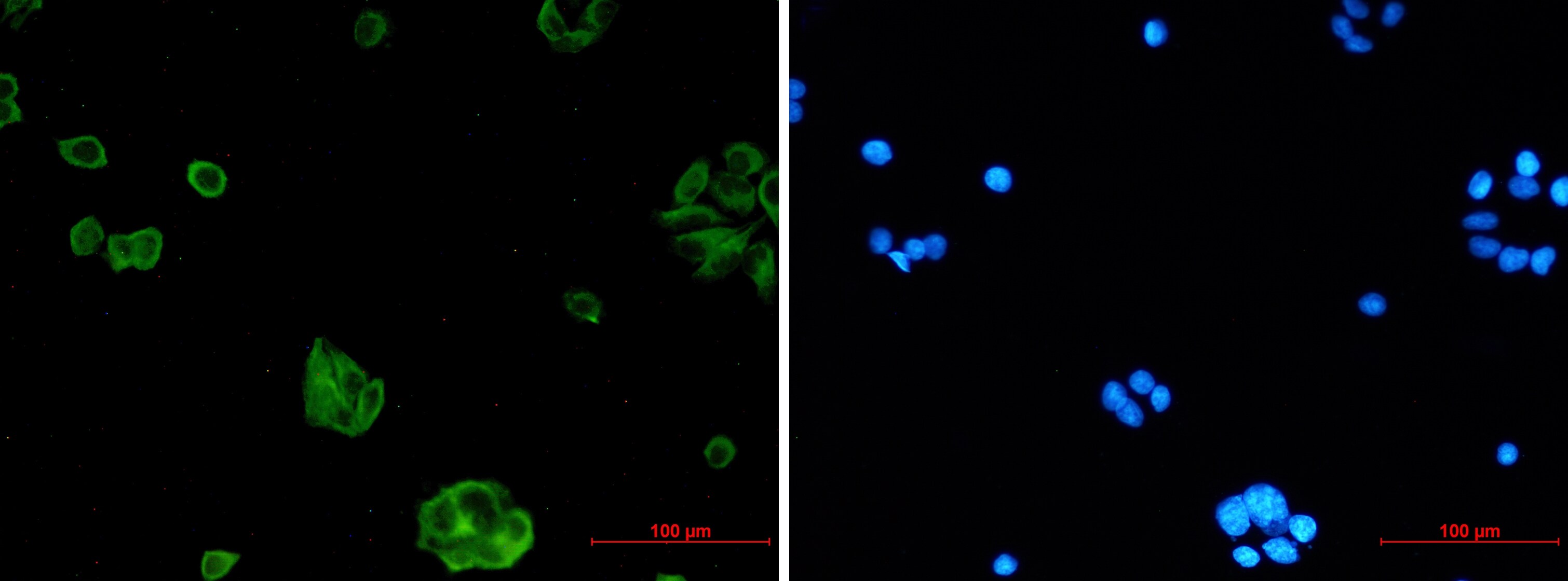 NgR3/NgRH2/RTN4RL1 Antibody (S03-6C3)