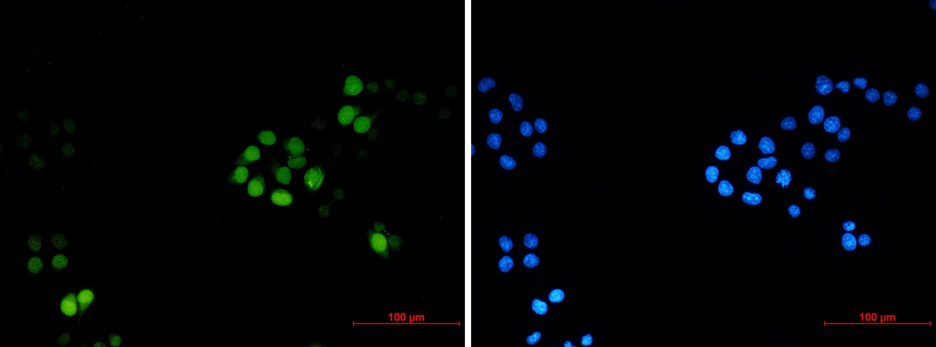 TPX2 Antibody (S01-8A6)