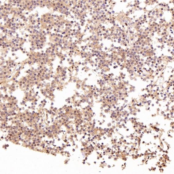 LRP-1 Antibody (S09-4E8)
