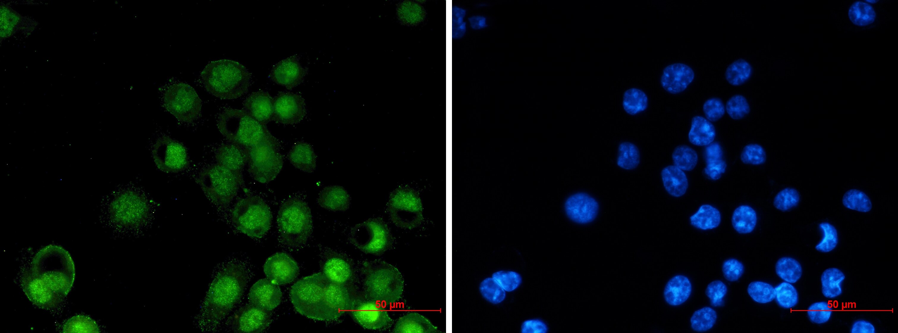 RXR alpha/NR2B1 Antibody (S04-6C3)
