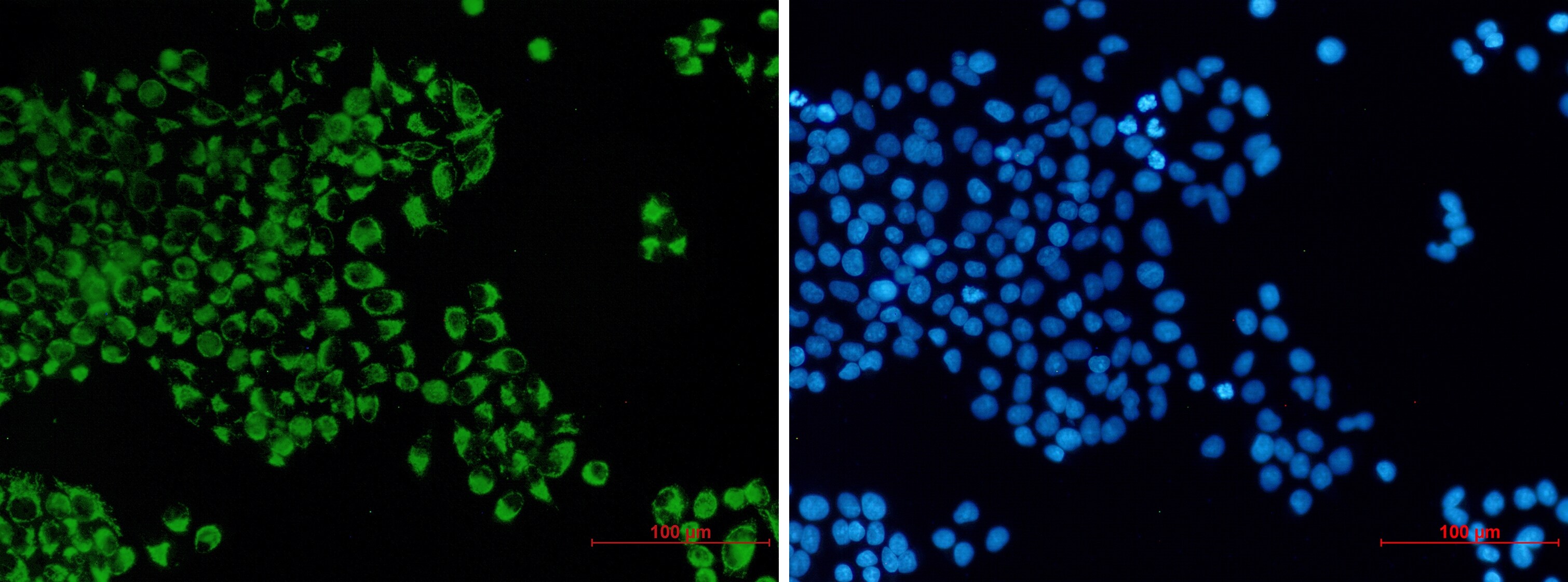 Bcl G Antibody (S06-3D8)
