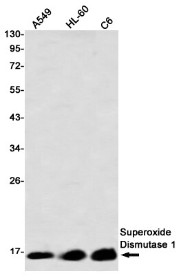 SOD1/Cu-Zn SOD Antibody (S08-5A5)