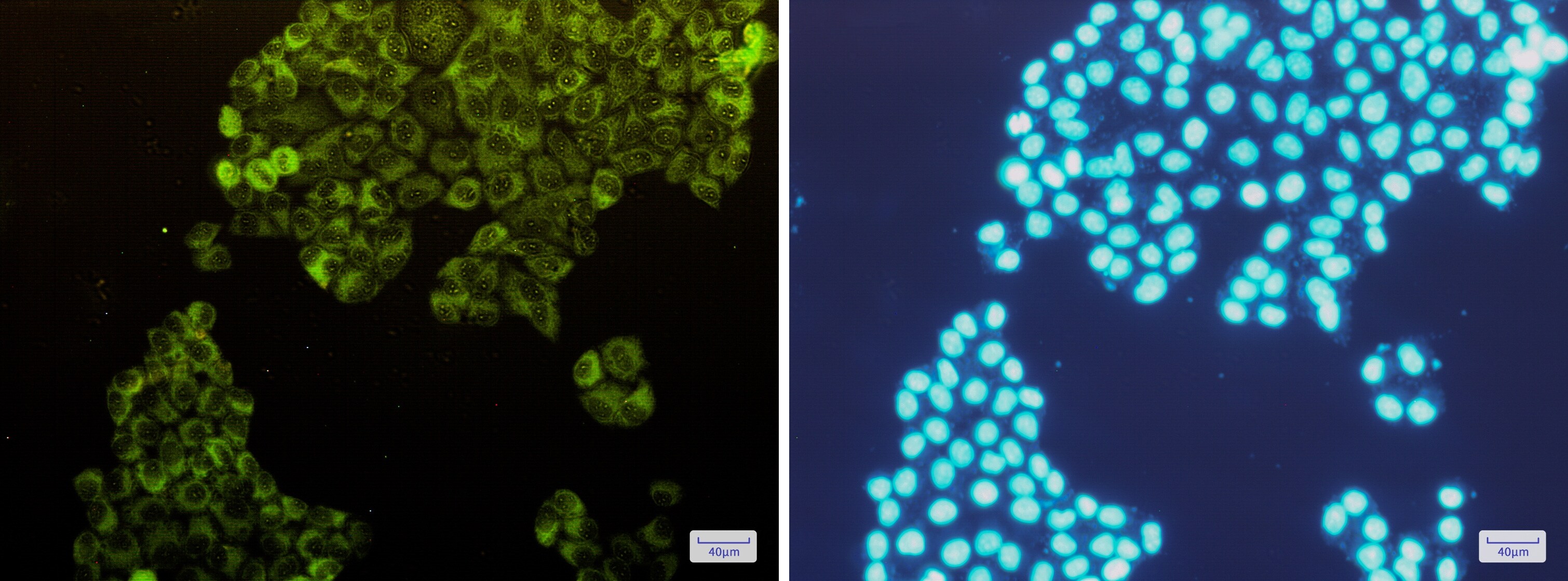 Muscle Phosphofructokinase/PFKM/PFK-1 Antibody (S08-6B4)