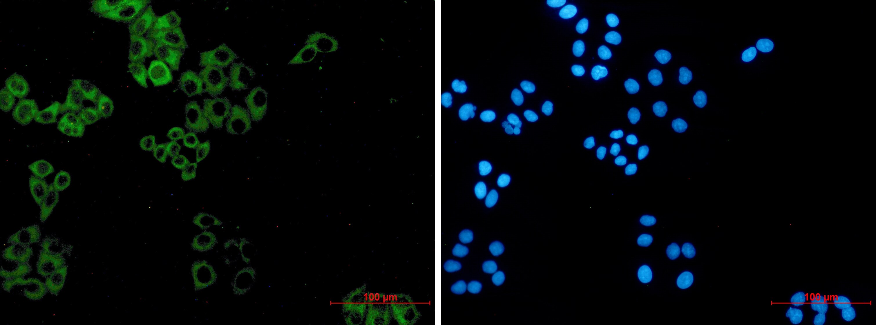 Paxillin Antibody (S04-3C3)