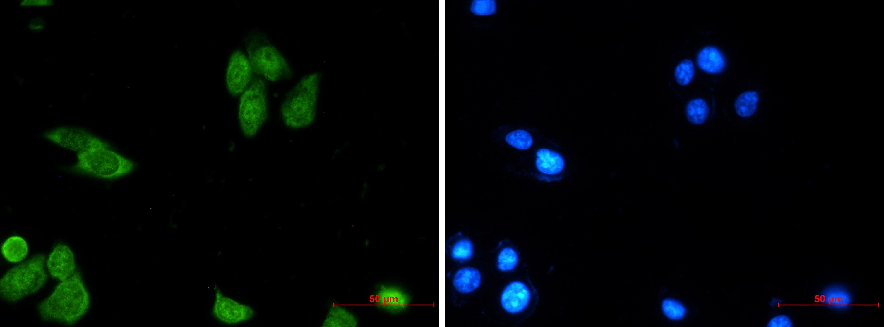 Survivin Antibody (S04-1B1)