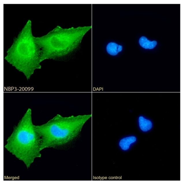 gamma-Synuclein Antibody (SAIC-31A-10) - Azide and BSA Free